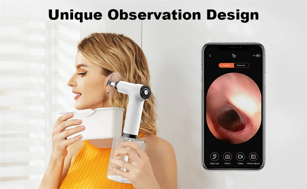 Electric Ear Cleaning Kit Ear Irrigation Flushing System Ear Wax Water Removal Safe Ear Wax Removal Ear Washer Effective Cleaner