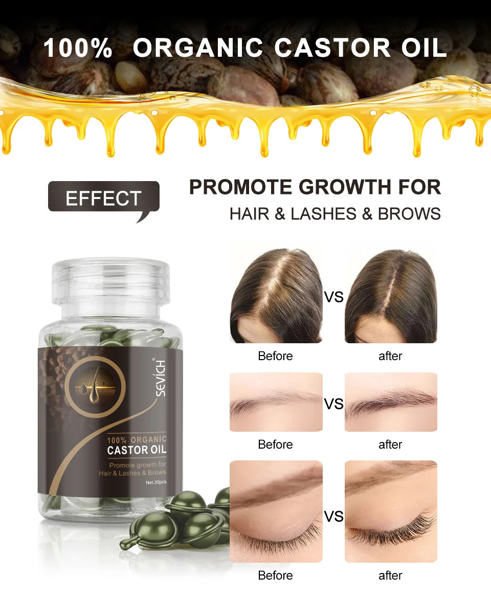 Sevich 2PCS/Set Ginger Hair Growth Capsules Set Hair Vitamin Oil For Hair Loss Repair Treatment Damaged Hair Black Hair Serum