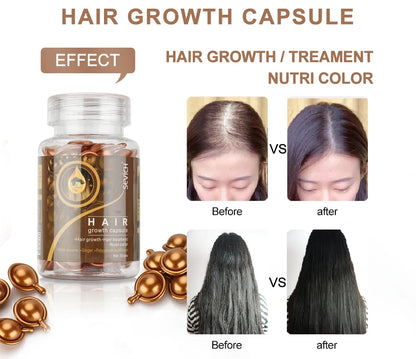 Sevich 2PCS/Set Ginger Hair Growth Capsules Set Hair Vitamin Oil For Hair Loss Repair Treatment Damaged Hair Black Hair Serum