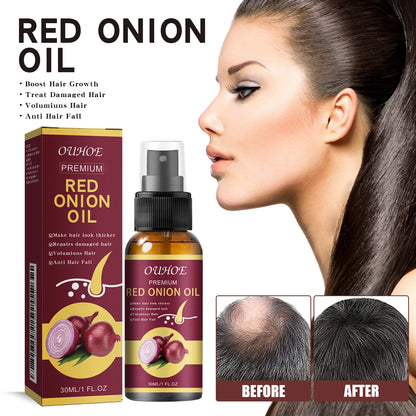 Red Onion Hair Growth Essential Oil Hair Care Spray Prevent Hair Loss Nourish Hair Roots Improve Hair Texture Hair Care Products